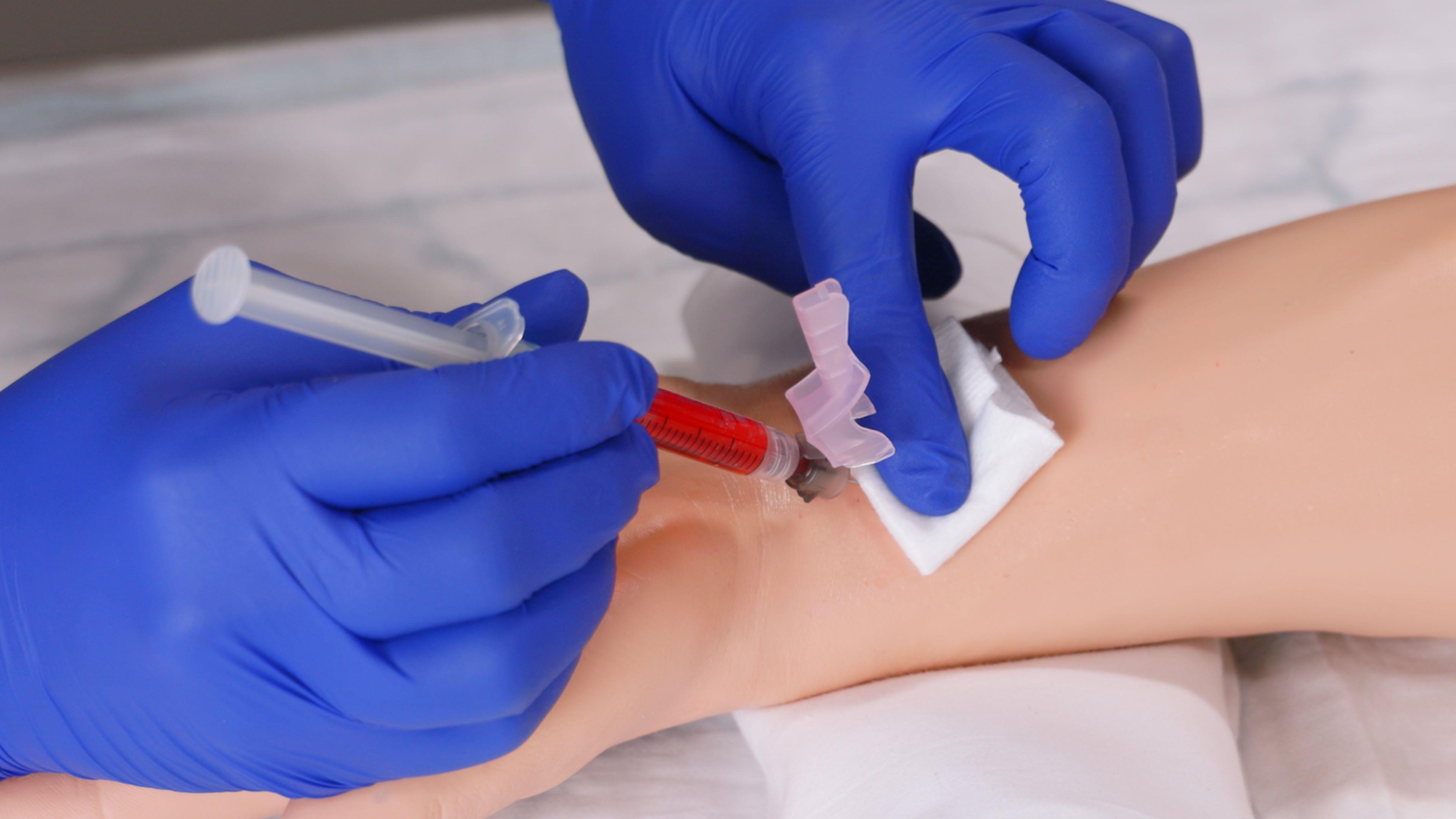 Demonstration of blood taken for Arterial Blood Gas Sampling